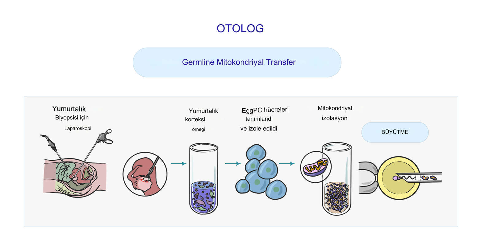 Otolog Mitokondriyal Transfer Nedir?